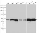 SHMT1 Antibody in Western Blot (WB)