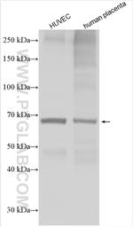 ST2 Antibody in Western Blot (WB)