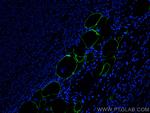 E-selectin/CD62E Antibody in Immunohistochemistry (PFA fixed) (IHC (PFA))