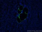 E-selectin/CD62E Antibody in Immunohistochemistry (PFA fixed) (IHC (PFA))