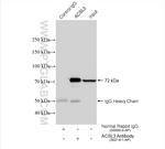 ACSL3 Antibody in Immunoprecipitation (IP)