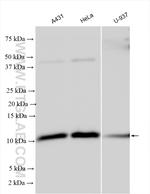 Beta-2-Microglobulin Antibody in Western Blot (WB)