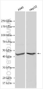 SCML1 Antibody in Western Blot (WB)