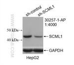 SCML1 Antibody in Western Blot (WB)