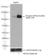 Phospho-EPHA2 (Tyr588) Antibody in Western Blot (WB)