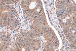 PSMB7 Antibody in Immunohistochemistry (Paraffin) (IHC (P))