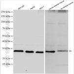 PSMB7 Antibody in Western Blot (WB)