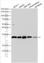 PSMB7 Antibody in Western Blot (WB)