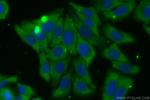 PFKM Antibody in Immunocytochemistry (ICC/IF)