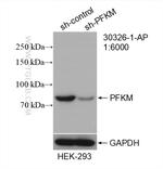 PFKM Antibody in Western Blot (WB)