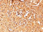 Hemoglobin alpha (2 chain) Antibody in Immunohistochemistry (Paraffin) (IHC (P))