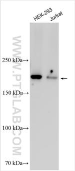 SYNJ2 Antibody in Western Blot (WB)