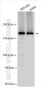 SYNJ2 Antibody in Western Blot (WB)