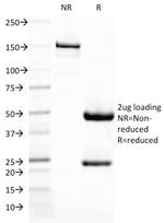 CD209/DC-SIGN (Pathogen Receptor on Dendritic Cells) Antibody in SDS-PAGE (SDS-PAGE)