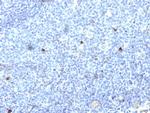 HLA-Aw32 and HLA-A25 (MHC I) Antibody in Immunohistochemistry (Paraffin) (IHC (P))