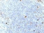 HLA-Aw32 and HLA-A25 (MHC I) Antibody in Immunohistochemistry (Paraffin) (IHC (P))