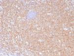 HLA-B (MHC Class I) Antibody in Immunohistochemistry (Paraffin) (IHC (P))