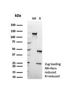 HLA-B (MHC Class I) Antibody in SDS-PAGE (SDS-PAGE)