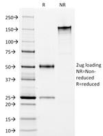 HLA-DP/-DR (MHC II) Antibody in SDS-PAGE (SDS-PAGE)