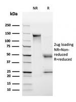 HLA-DP/-DQ/-DR (MHC II) Antibody in SDS-PAGE (SDS-PAGE)