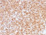 HLA-DP/-DQ/-DR (MHC II) Antibody in Immunohistochemistry (Paraffin) (IHC (P))