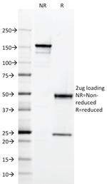 HLA-DQ (MHC II) Antibody in SDS-PAGE (SDS-PAGE)