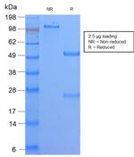 HLA-DQ (MHC II) Antibody in SDS-PAGE (SDS-PAGE)