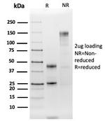 HLA-DR (MHC II) Antibody in SDS-PAGE (SDS-PAGE)