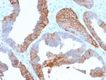 HLA-DR (MHC II) Antibody in Immunohistochemistry (Paraffin) (IHC (P))