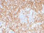 HLA-DR (MHC II) Antibody in Immunohistochemistry (Paraffin) (IHC (P))