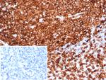 HLA-DR (MHC II) Antibody in Immunohistochemistry (Paraffin) (IHC (P))