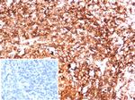 HLA-DR (MHC II) Antibody in Immunohistochemistry (Paraffin) (IHC (P))