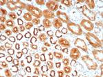 MR1/Major histocompatibility complex, class I-related Antibody in Immunohistochemistry (Paraffin) (IHC (P))