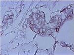 Mouse IgG (H+L) Secondary Antibody in Immunohistochemistry (Paraffin) (IHC (P))