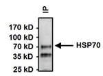 Mouse IgM Secondary Antibody in Immunoprecipitation (IP)