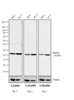 Rabbit IgG (H+L) Cross-Adsorbed Secondary Antibody in Western Blot (WB)