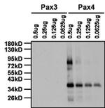 Rabbit IgG (H+L) Secondary Antibody in Western Blot (WB)