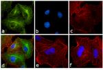 Rat IgG (H+L) Secondary Antibody in Immunocytochemistry (ICC/IF)