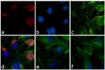 Rabbit IgG (H+L) Secondary Antibody in Immunocytochemistry (ICC/IF)