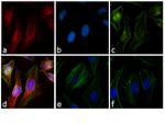 Rabbit IgG (H+L) Cross-Adsorbed Secondary Antibody in Immunocytochemistry (ICC/IF)