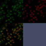 FOXA1/HNF3A Antibody in Immunocytochemistry (ICC/IF)