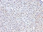 FOXA1/HNF3A Antibody in Immunohistochemistry (Paraffin) (IHC (P))