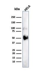 FOXA1/HNF3A Antibody in Western Blot (WB)