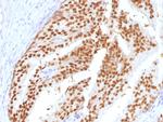 FOXA1/HNF3A Antibody in Immunohistochemistry (Paraffin) (IHC (P))