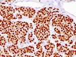 FOXA1/HNF3A Antibody in Immunohistochemistry (Paraffin) (IHC (P))