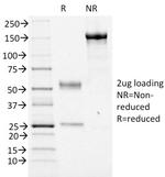 FOXA1/HNF3A Antibody in SDS-PAGE (SDS-PAGE)