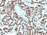 FOXA1/HNF3A Antibody in Immunohistochemistry (Paraffin) (IHC (P))