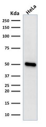 FOXA1/HNF3A Antibody in Western Blot (WB)