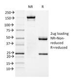 FOXA1/HNF3A Antibody in SDS-PAGE (SDS-PAGE)