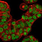 FOXA1/HNF3A Antibody in Immunocytochemistry (ICC/IF)